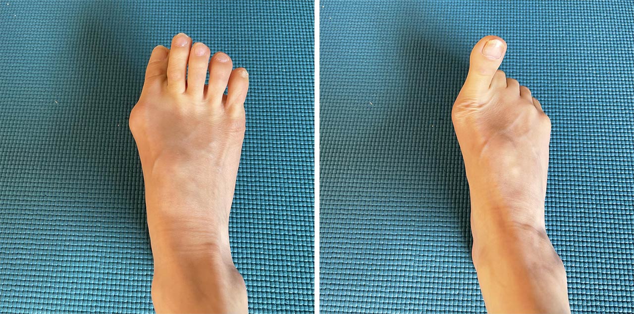 足指チョキは親指の上げ下げの違いで２種類。どちらもできるかな？