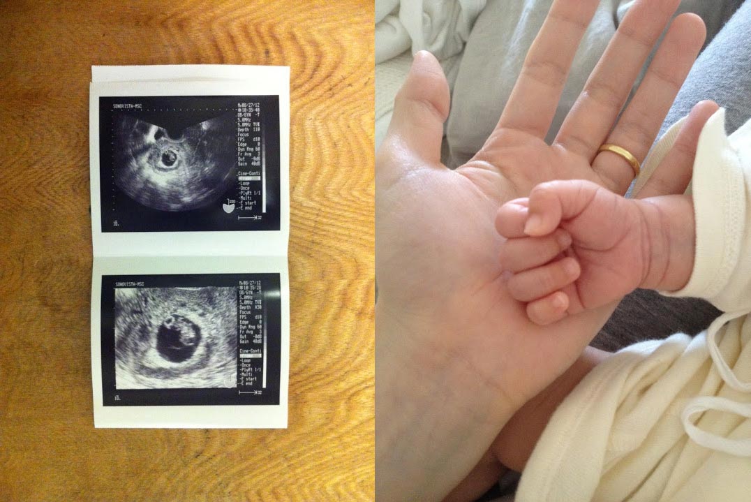 （左）初めて赤ちゃんを確認できたエコー写真。（右）赤ちゃんの手や足を見るのが大好き。